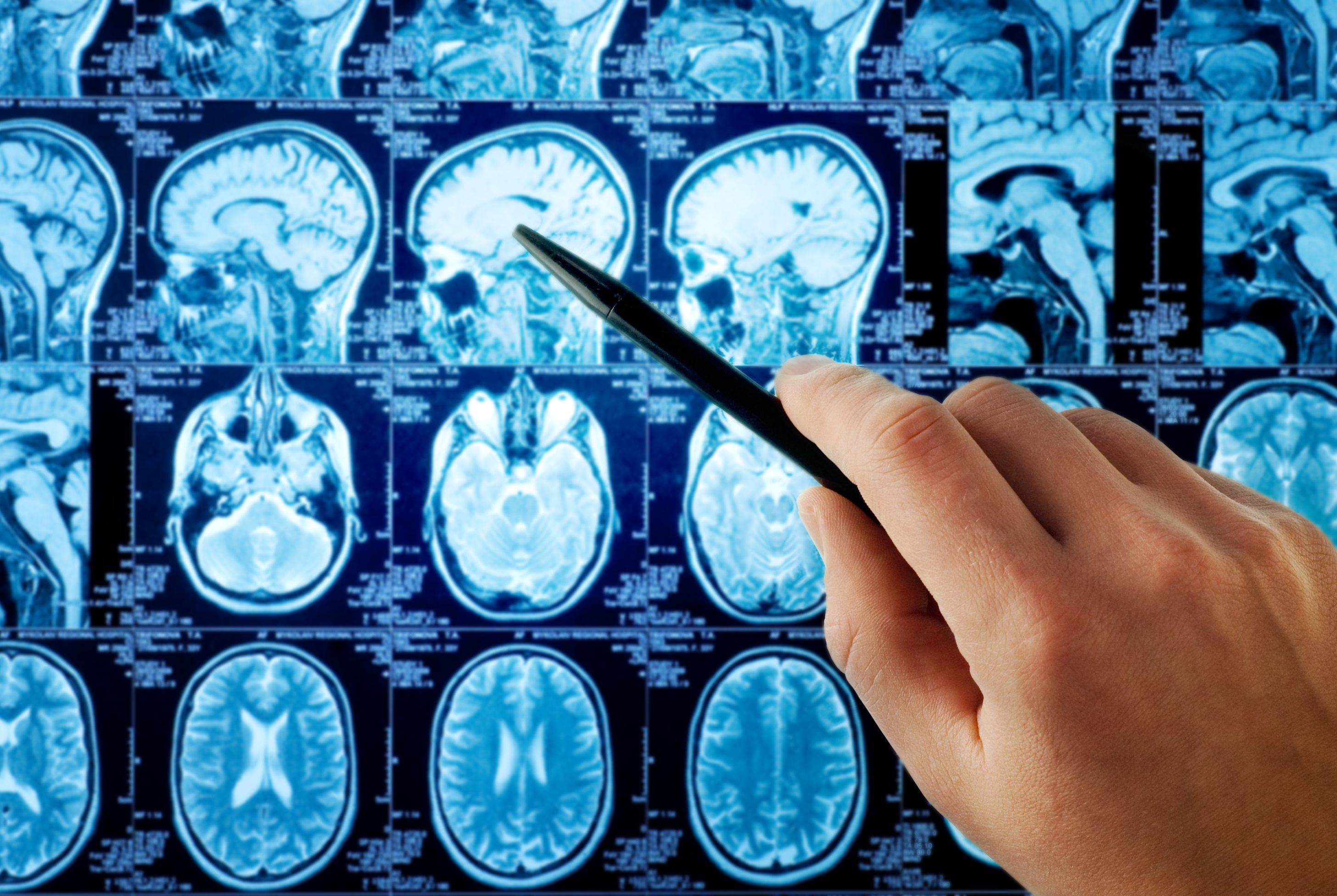 Baptist Health Neuroscience Partners - Neurology